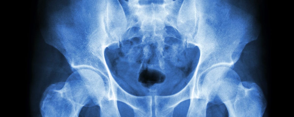 The Sacroiliac Joint: Anatomy, Function, and Common Conditions | Spine